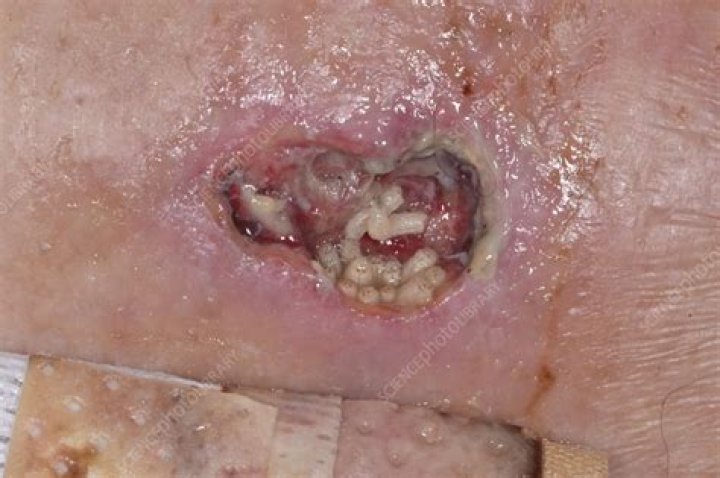Become maggot-infested