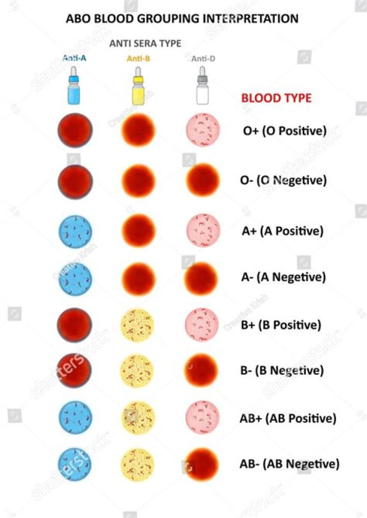 Blood ___ (O-positive for example)
