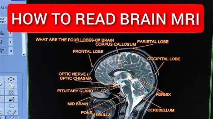 Brain scan: Abbr.