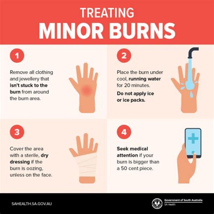 Burn a little