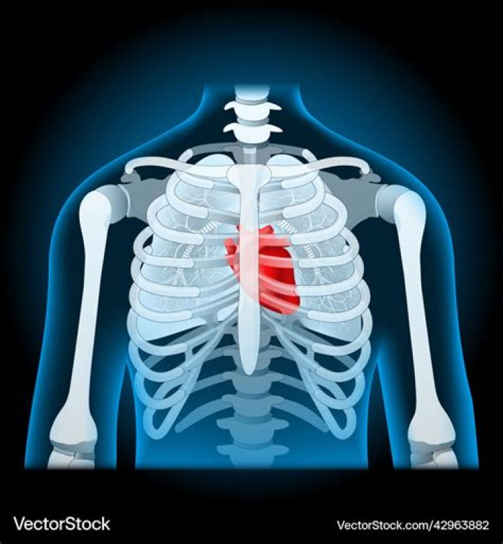 Chest-protecting bone
