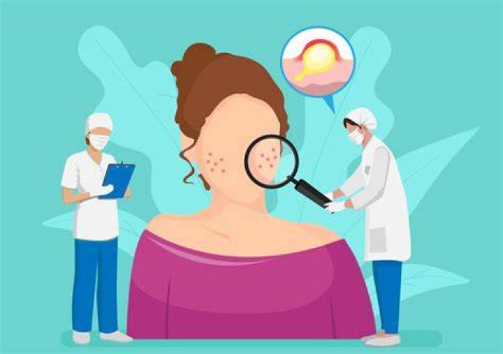 Condition often treated by a dermatologist