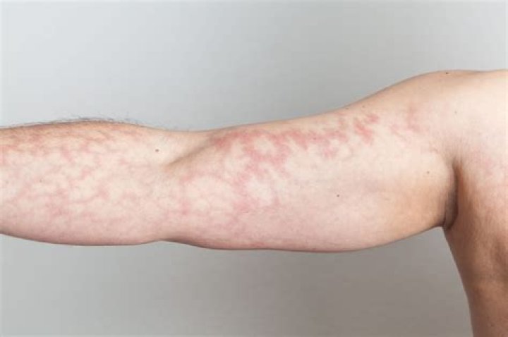 Covered with irregular spots