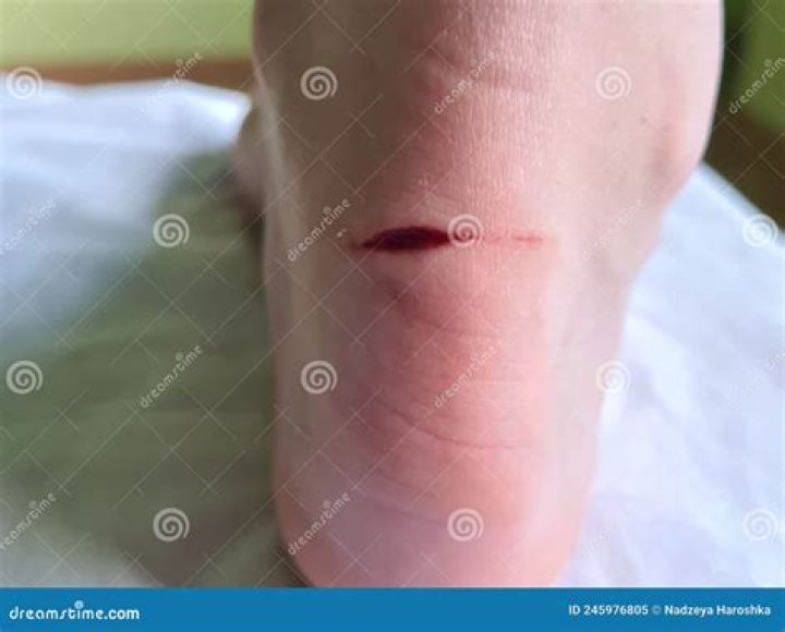 Deep cut