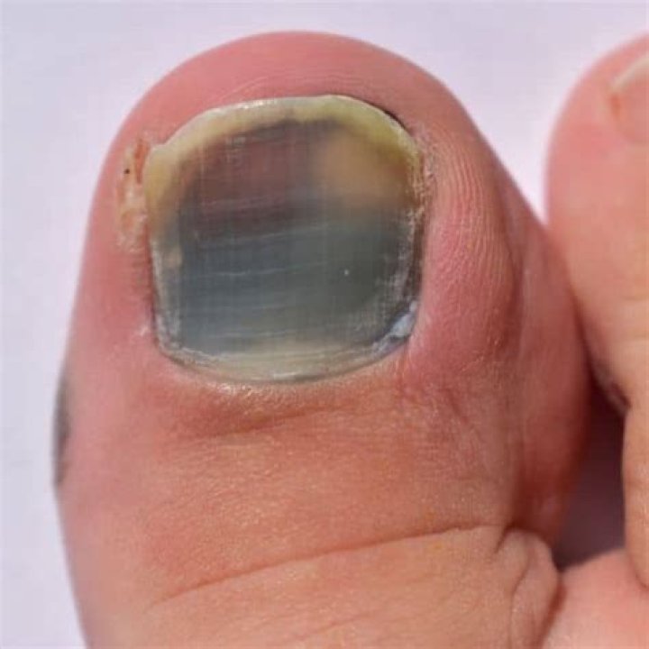 Exclamation after stubbing your toe perhaps