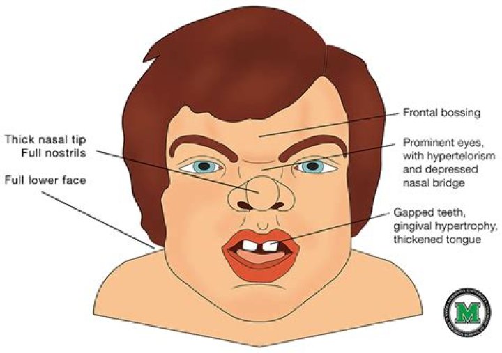 Facial feature that may be arched