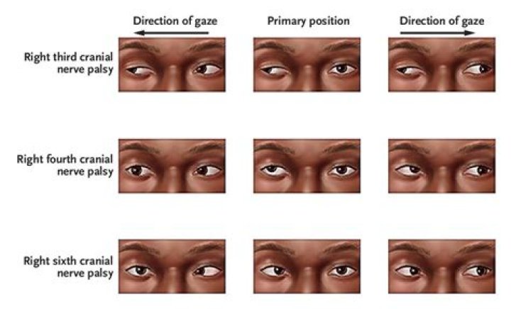 Keep a constant gaze