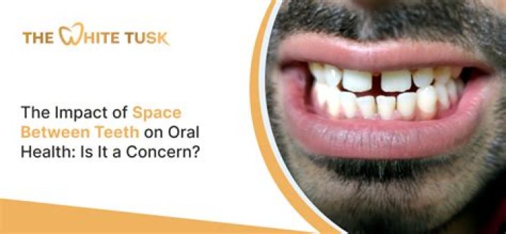 Space between teeth