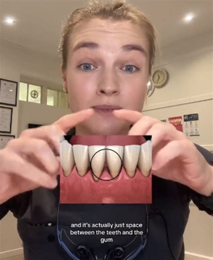 Space between two teeth