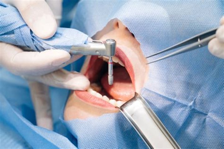 ___ surgery (dental operation)