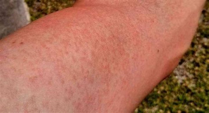 Tan-causing ray: Abbr.