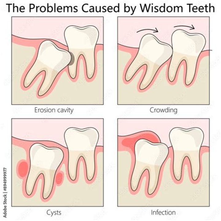 Tummy or tooth problem