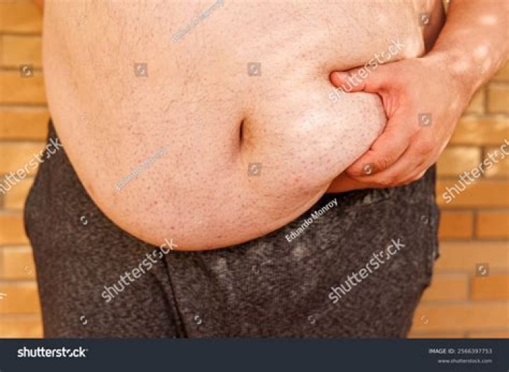 Very fat