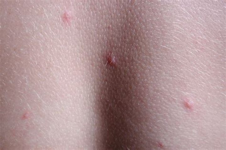 Very small bite