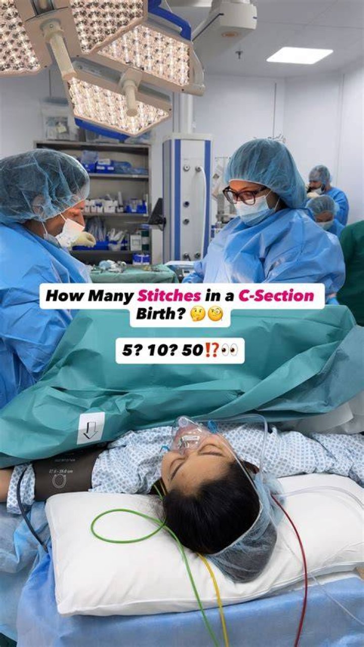 Where C-sections are performed: Abbr.